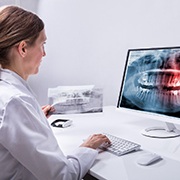 Implant dentist in Buckhead viewing an X-ray on a computer