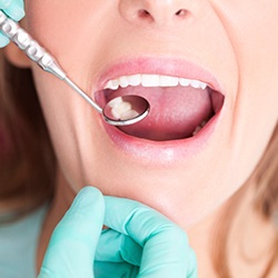 Closeup of patient receiving dental care