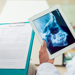 Skull and jawbone x-rays on tablet computer