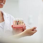 Dentist showing a patient a dental implant model