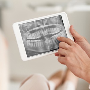 Dental x-rays on tablet computer