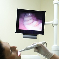 Intraoral images on computer screen