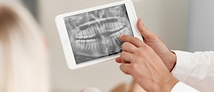 Dental x-rays on tablet computer