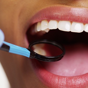 Closeup of smile during dental care