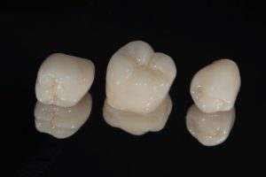 three dental crowns in Buckhead against black background