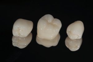 three dental crowns in Buckhead against black background 