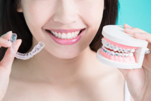closeup image of clear braces