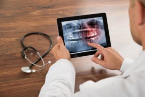 digital x-ray image of teeth
